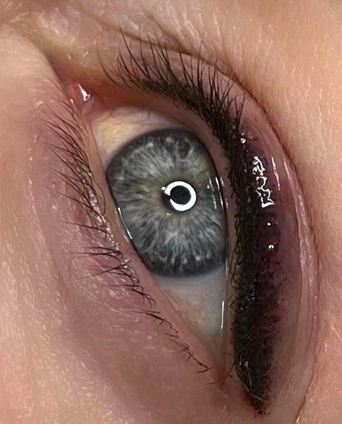 unnamed image